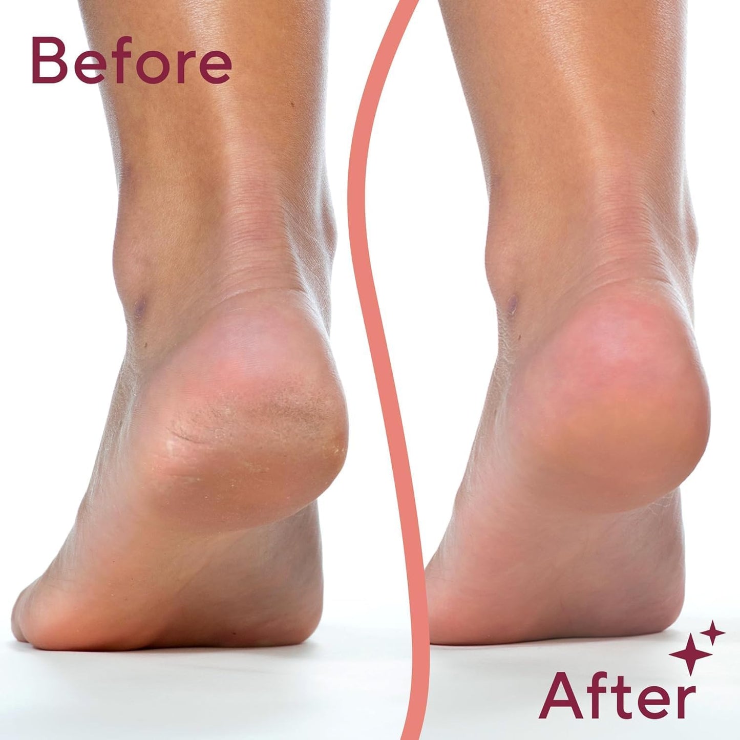 Electric Foot Callus Remover - Perfect Mother's Day Gift for Spa-Like Pedicures at Home